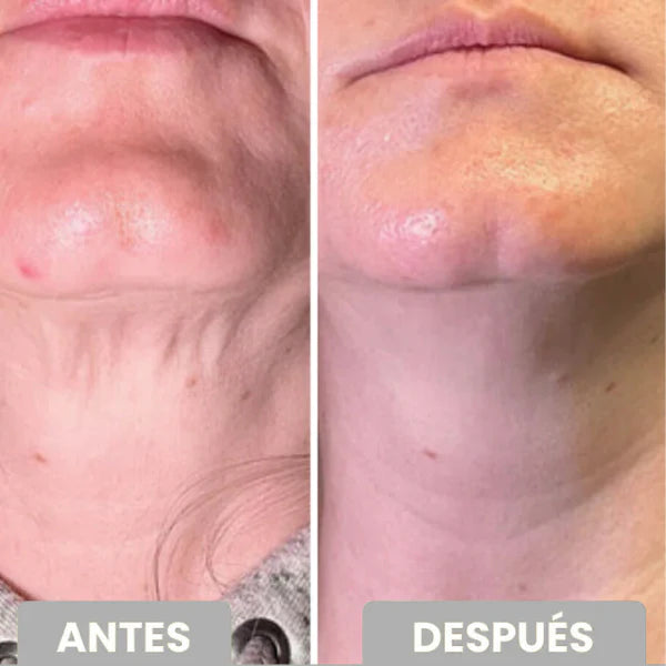 CREMA REAFIRMANTE Y TONIFICANTE PARA CUELLO Y ESCOTE