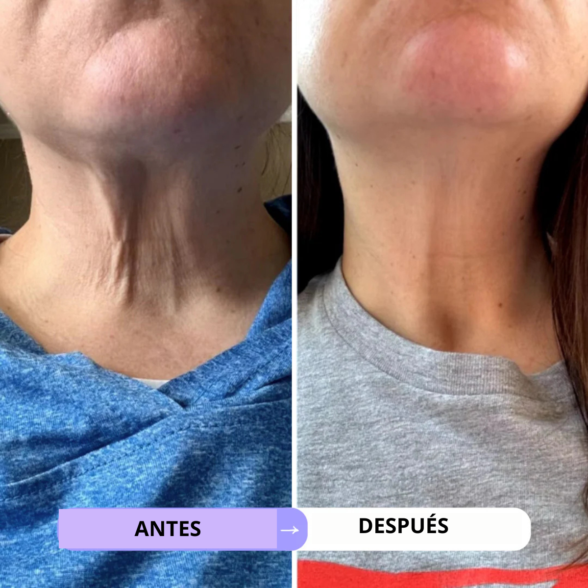 CREMA REAFIRMANTE Y TONIFICANTE PARA CUELLO Y ESCOTE