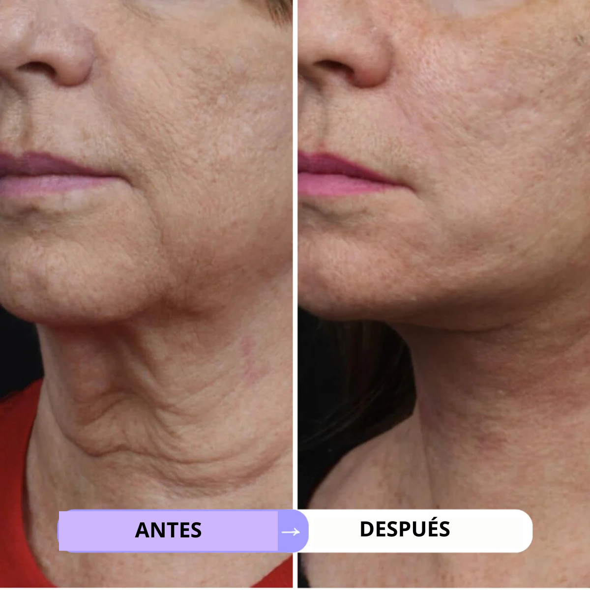 CREMA REAFIRMANTE Y TONIFICANTE PARA CUELLO Y ESCOTE