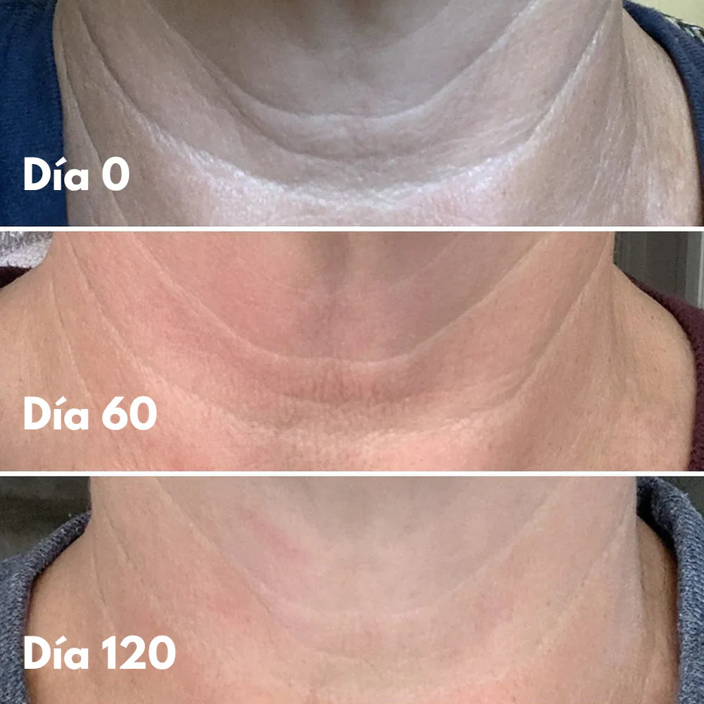 CREMA REAFIRMANTE Y TONIFICANTE PARA CUELLO Y ESCOTE